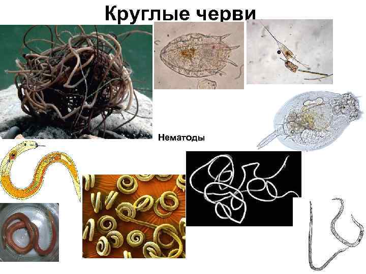 Круглые черви тип беспозвоночных