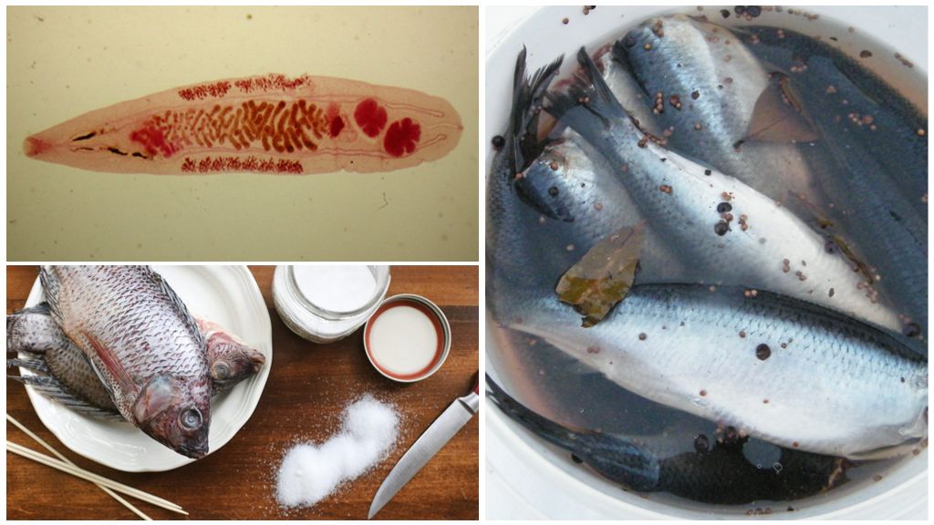 Какая рыба болеет описторхозом ✳ 10 советов от наших домохозяек