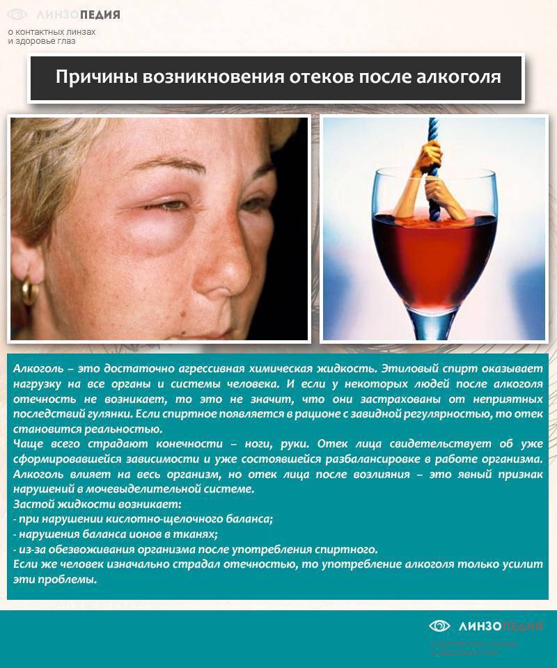 «вертолеты» после пьянки — о чем говорят и как от них избавиться?