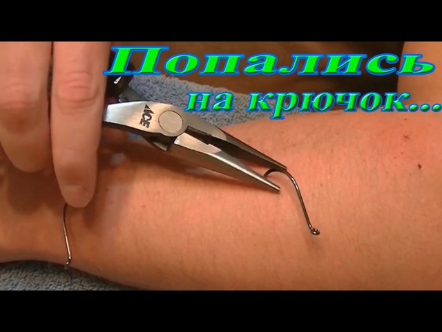 Подошвенная бородавка: как навсегда распрощаться с болью и дискомфортом?